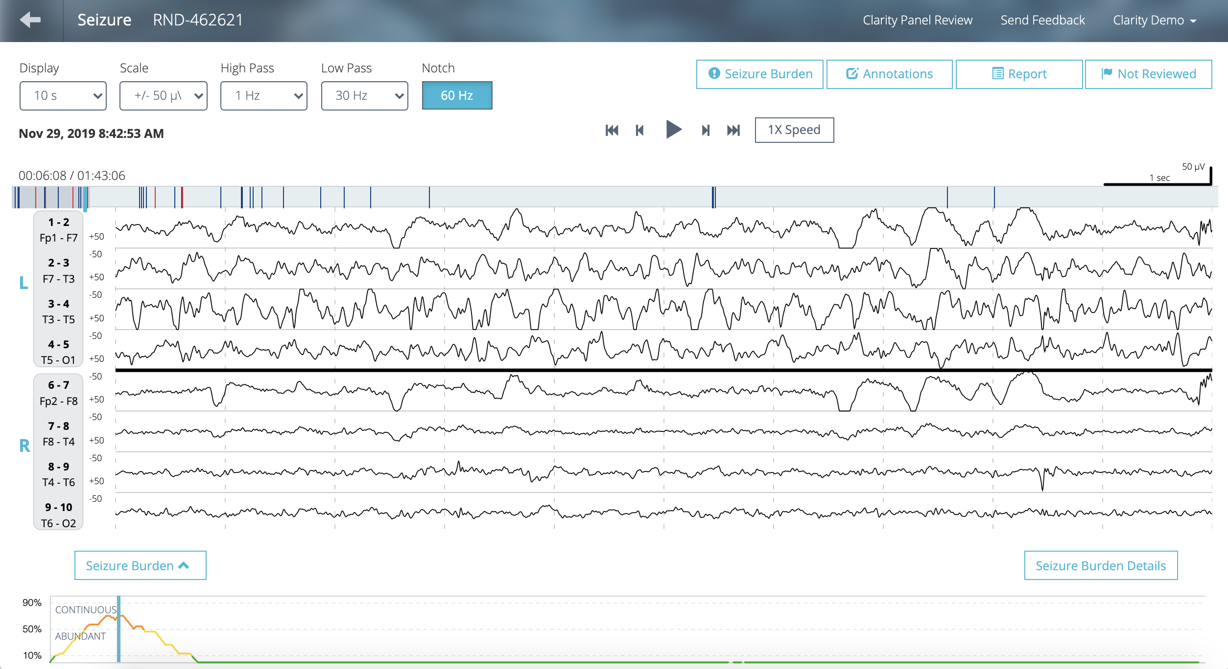 Rapid Response EEG Ceribell