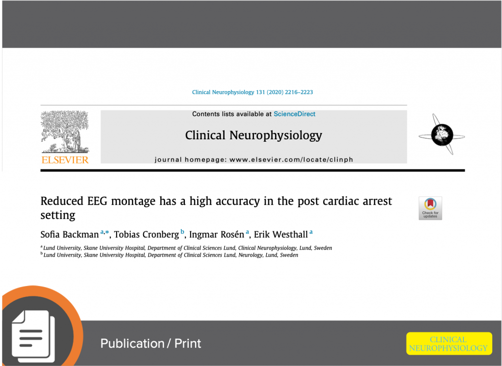 A clinical evaluation of a novel algorithm in the reliable detection of  epileptic seizures - ScienceDirect