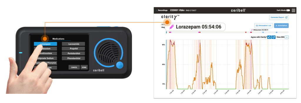 Ceribell brings power of AI to seizure management