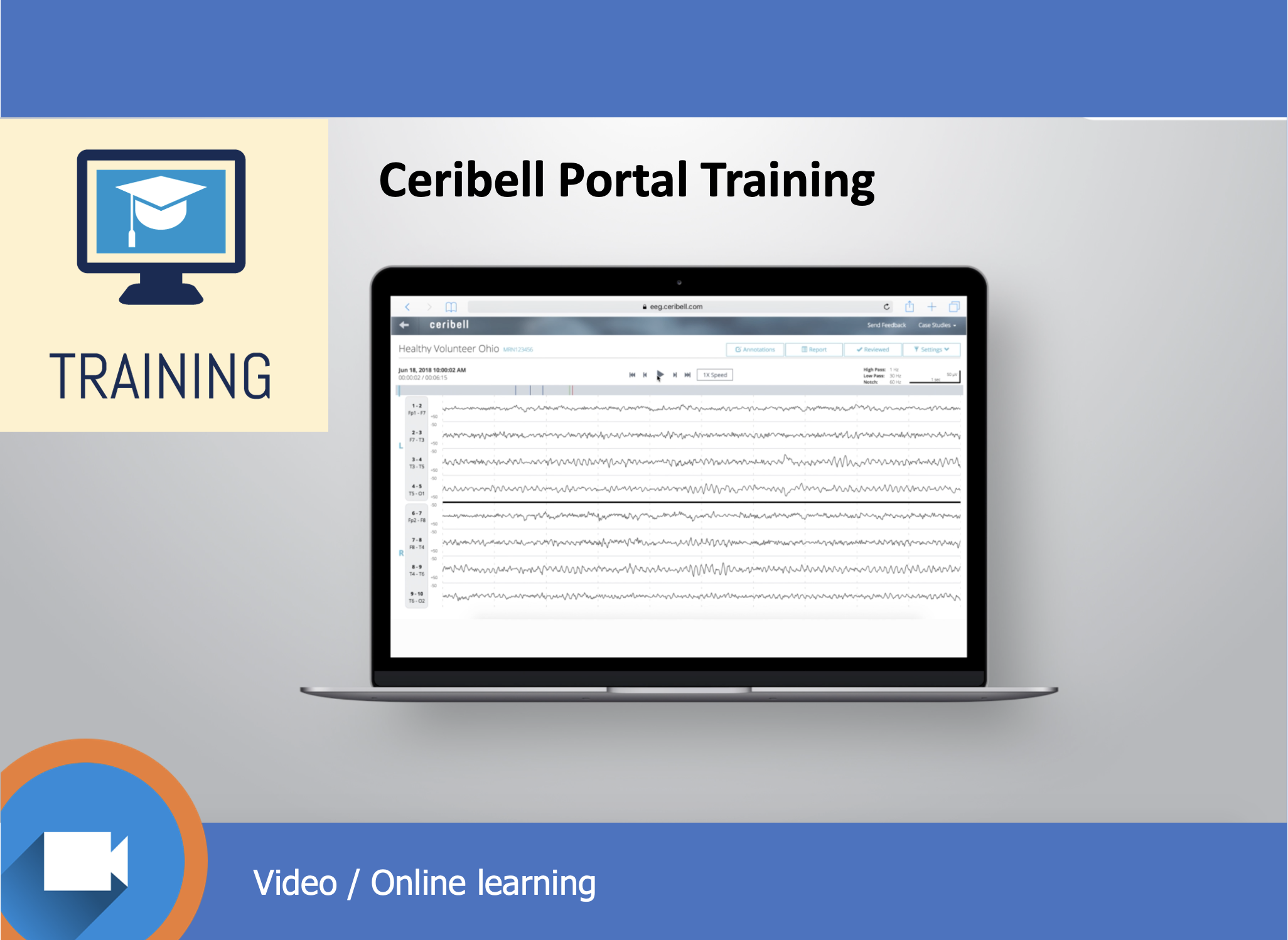 Ceribell Portal Training