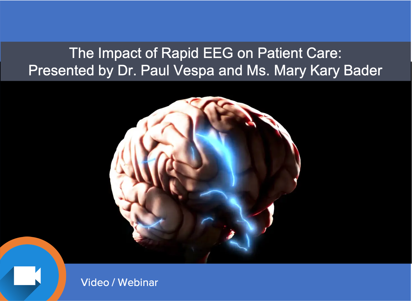 NCSE and the Impact of Rapid EEG