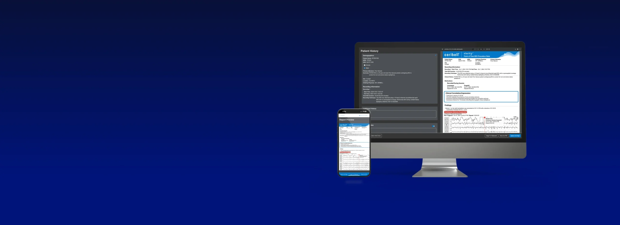 Desktop and mobile showing streamlined reports