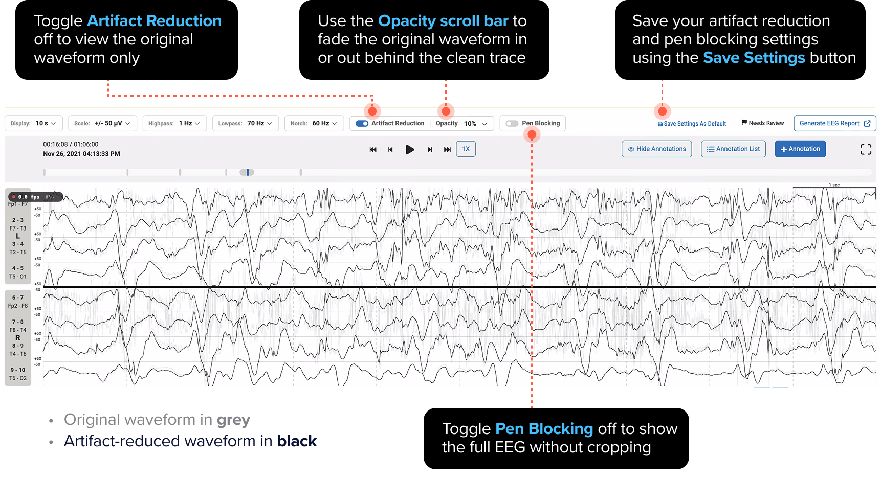Artifact Reduction controls in the Ceribell EEG viewer, with original waveform shown in grey and the artifact-reduced waveform in black